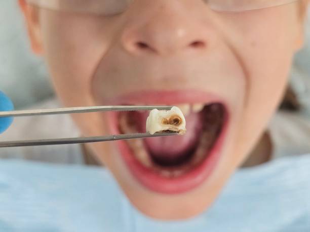 Best Emergency Denture Repair in George Mason, VA